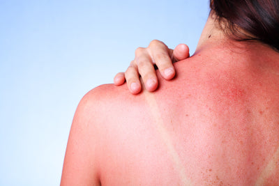 Intelligenter Sonnenschutz: Wie man Schäden durch die Sonne auf der Brust verhindern kann